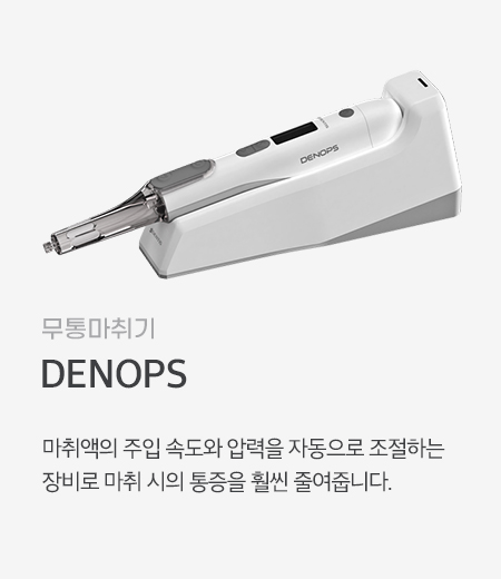 DENOPS