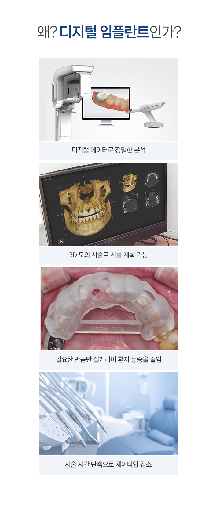 왜 디지털 임플란트인가?