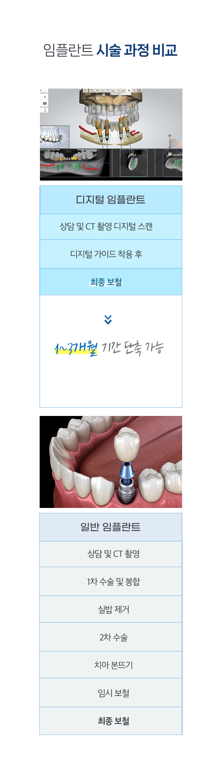 임플란트 시술 과정 비교