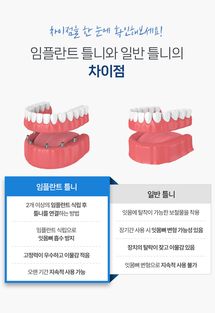 임플란트 틀니와 일반 틀니의 차이점