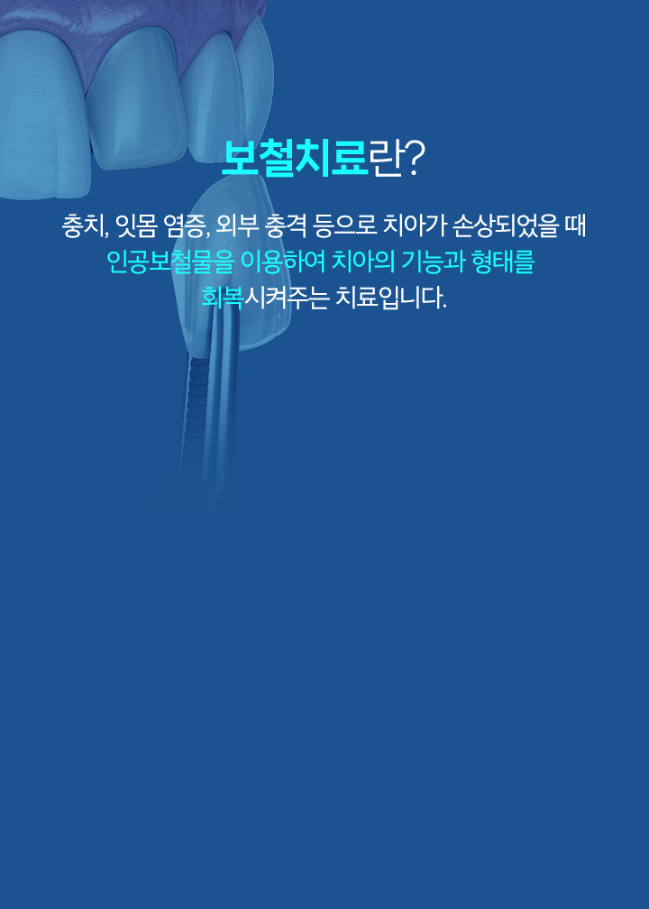 치과 수술 시, 아스피린을 끊어야 한다고 들어셨나요?