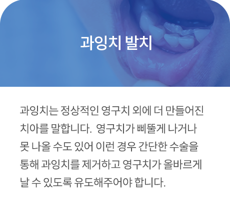 과잉치 발치