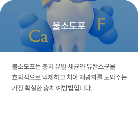 불소도포