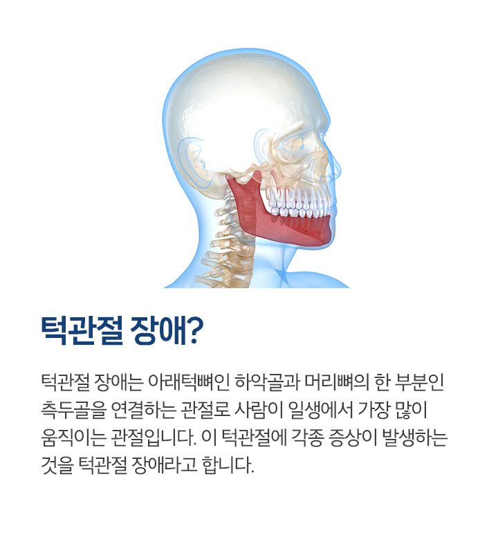 턱관절 장애?