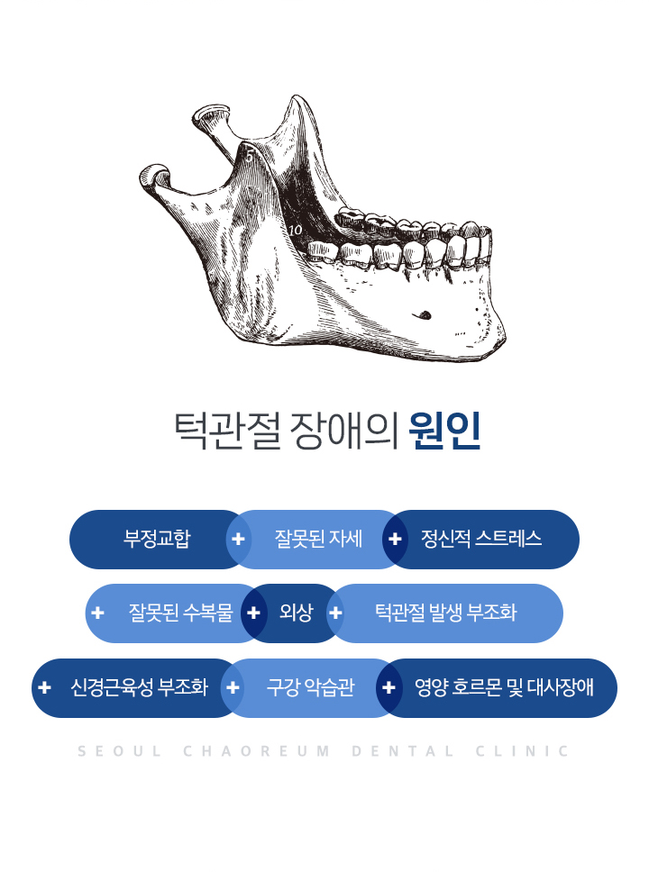 턱관절 장애의 원인