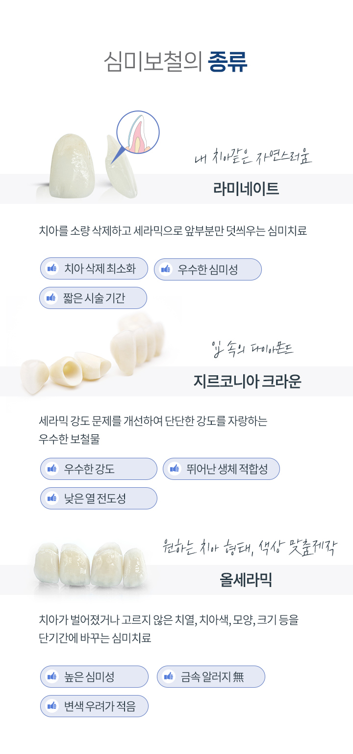 심미보철의 종류