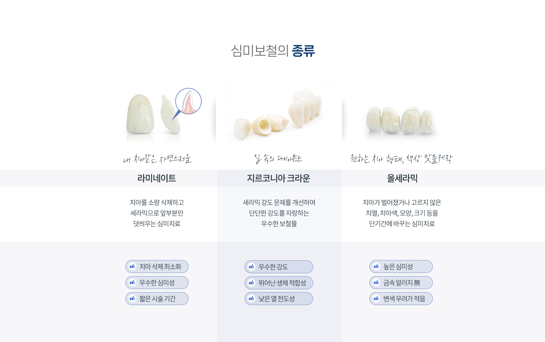 심미보철의 종류