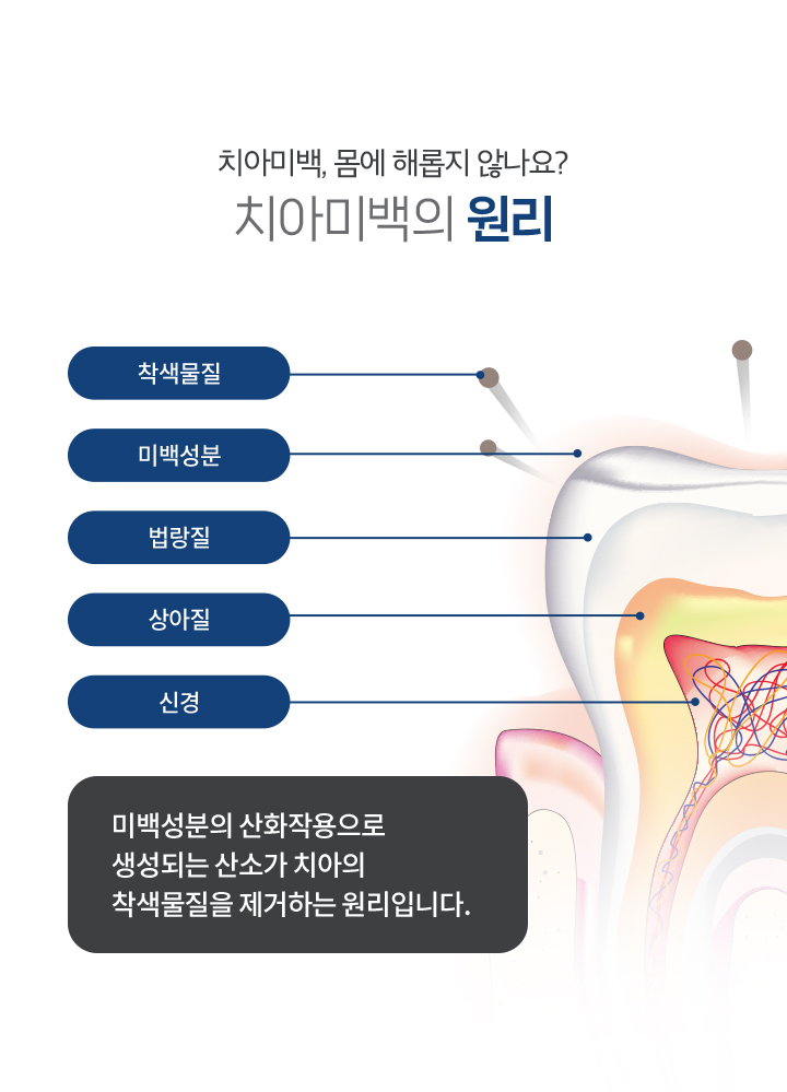 치아미백의 원리