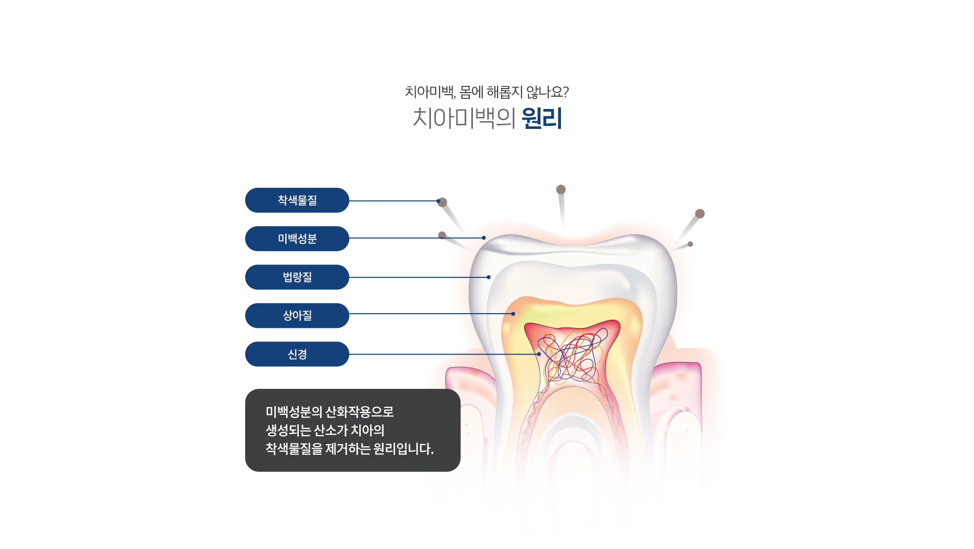 치아미백의 원리