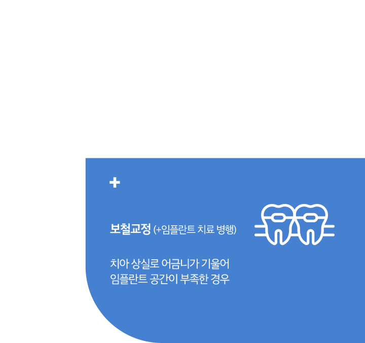 보철교정